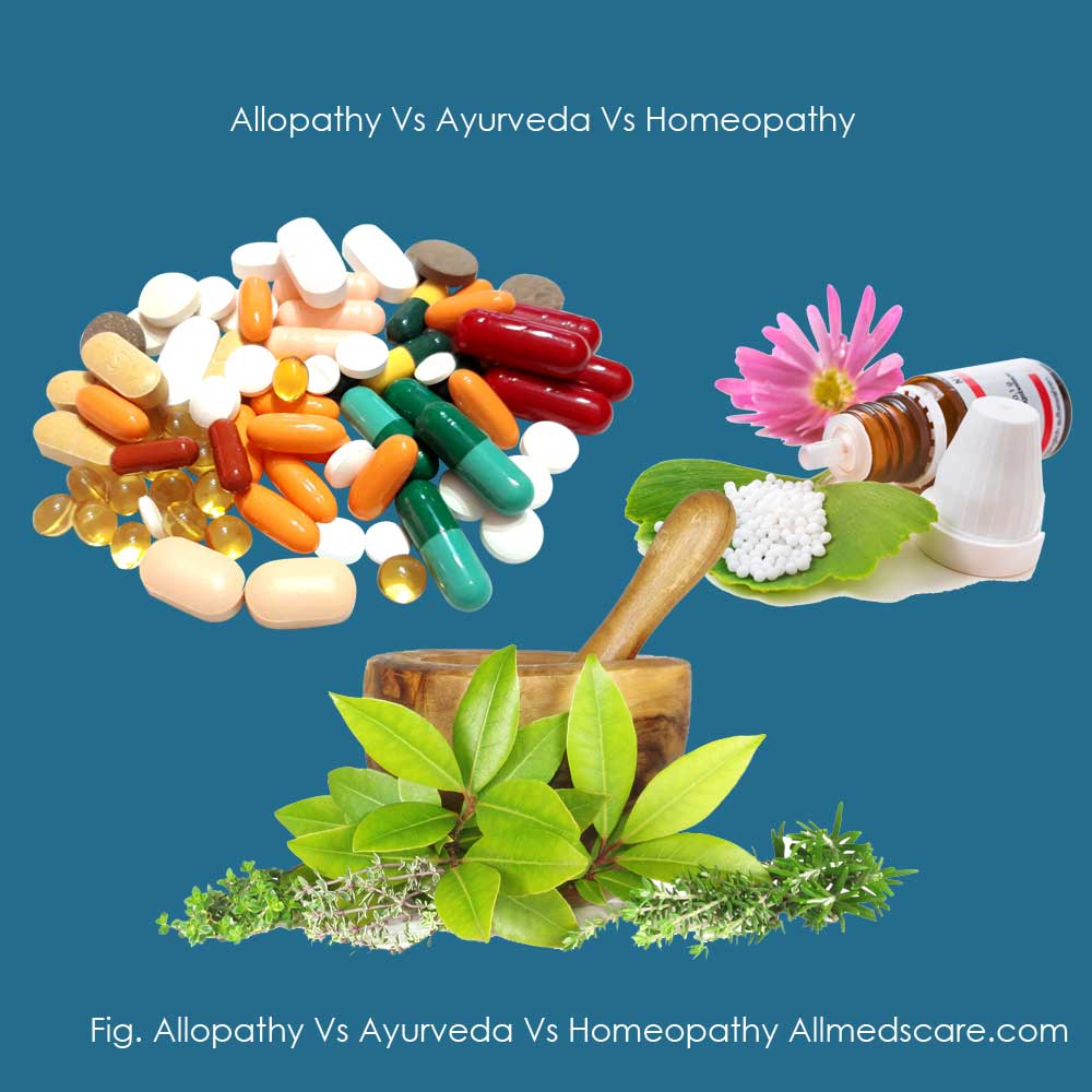Allopathy Vs Ayurveda Vs Homeopathy Treatments-Allmedscare.com