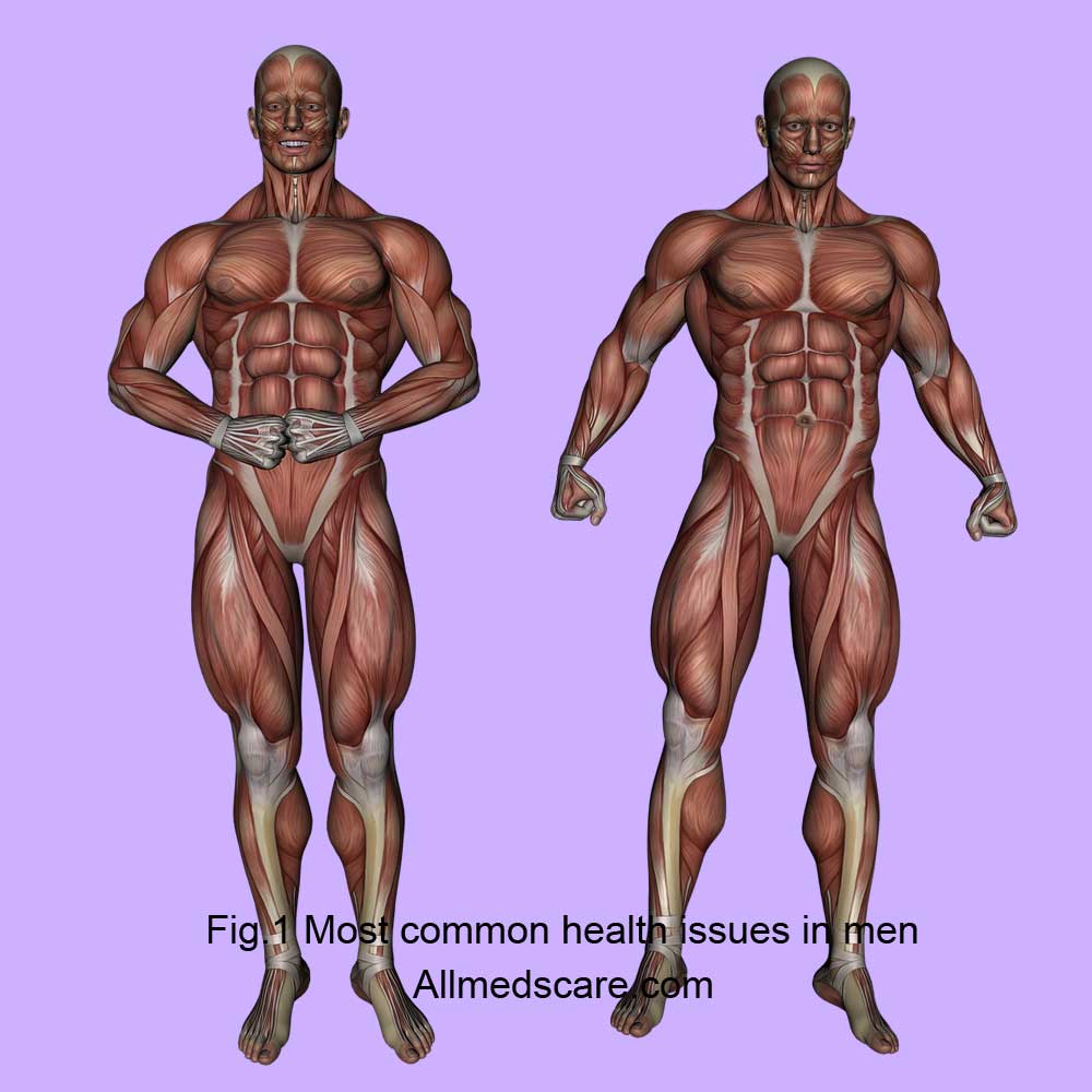 Most common health issues in men - Allmedscare.com