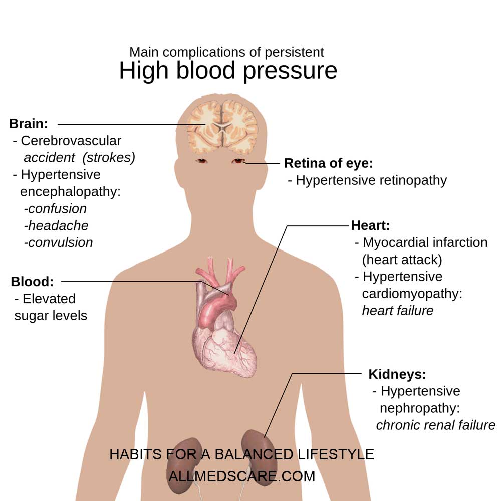 High Blood Pressure Causes and Treatment