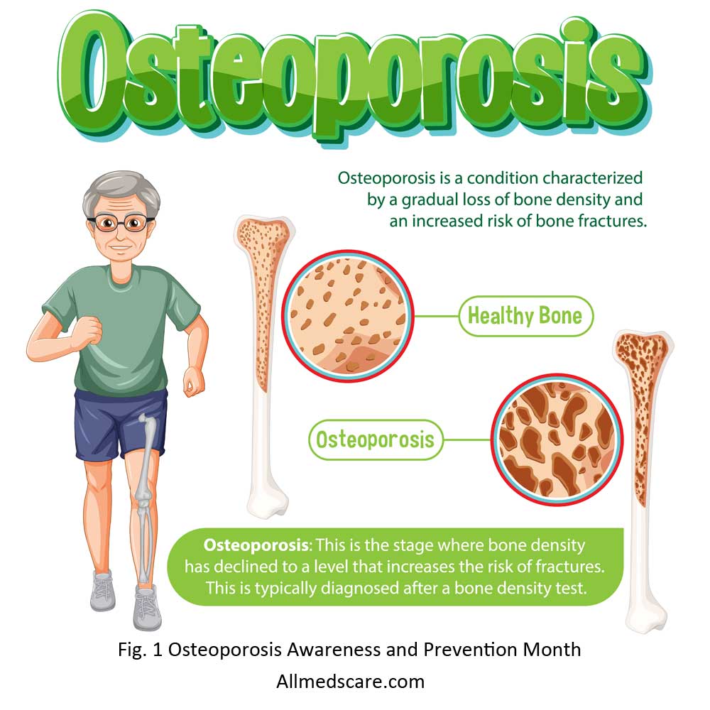 Osteoporosis Awareness and Prevention Month