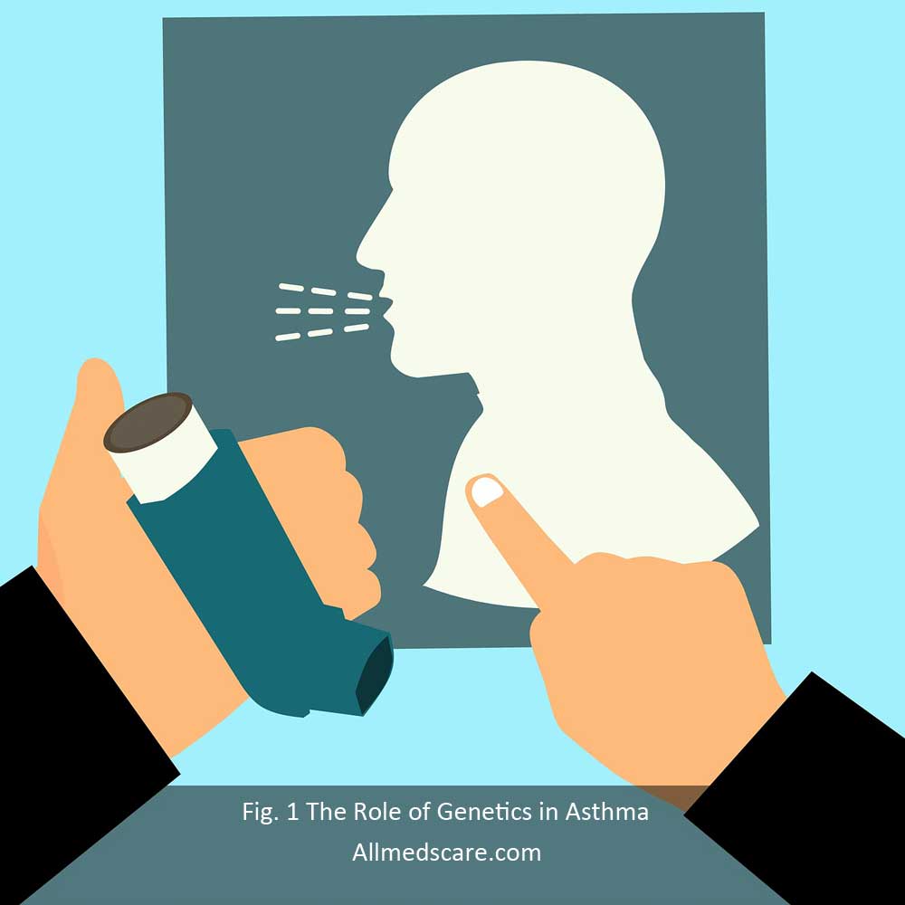 The Role of Genetics in Asthma