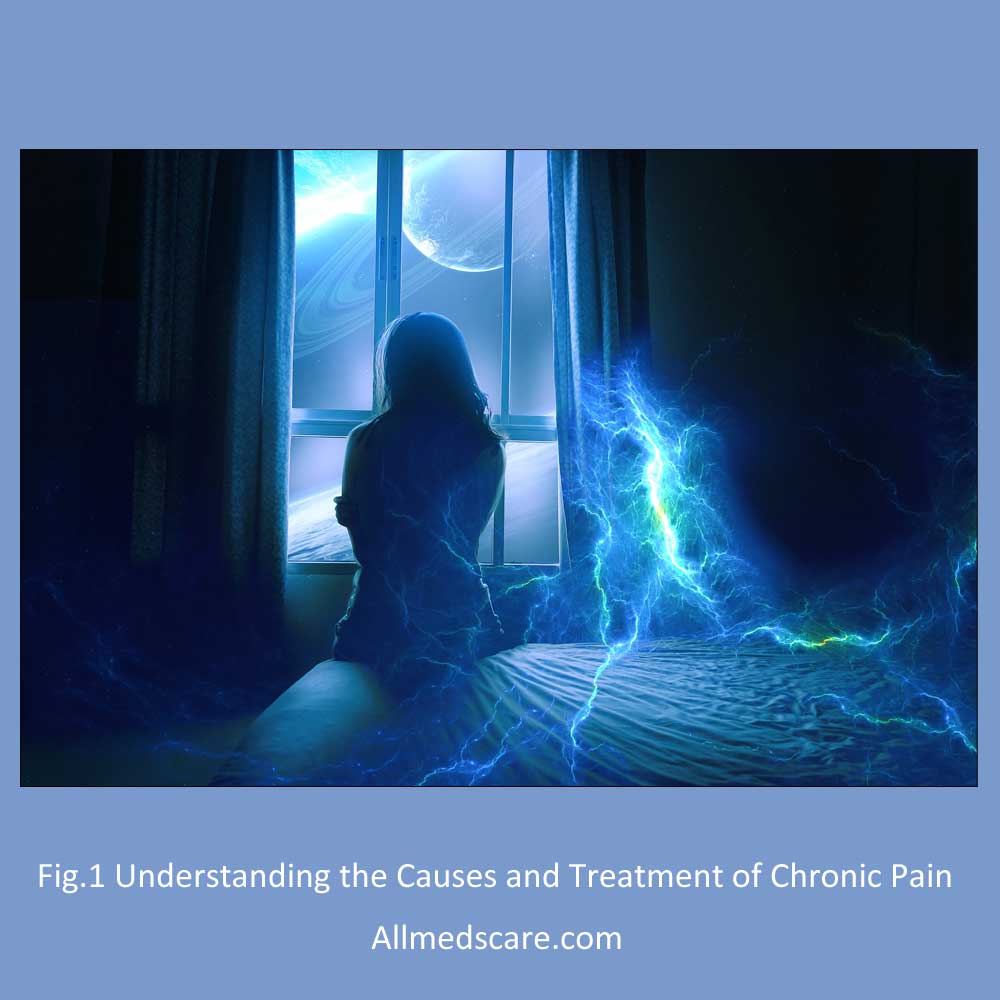 Causes and Treatment of Chronic Pain Allmedscare.com