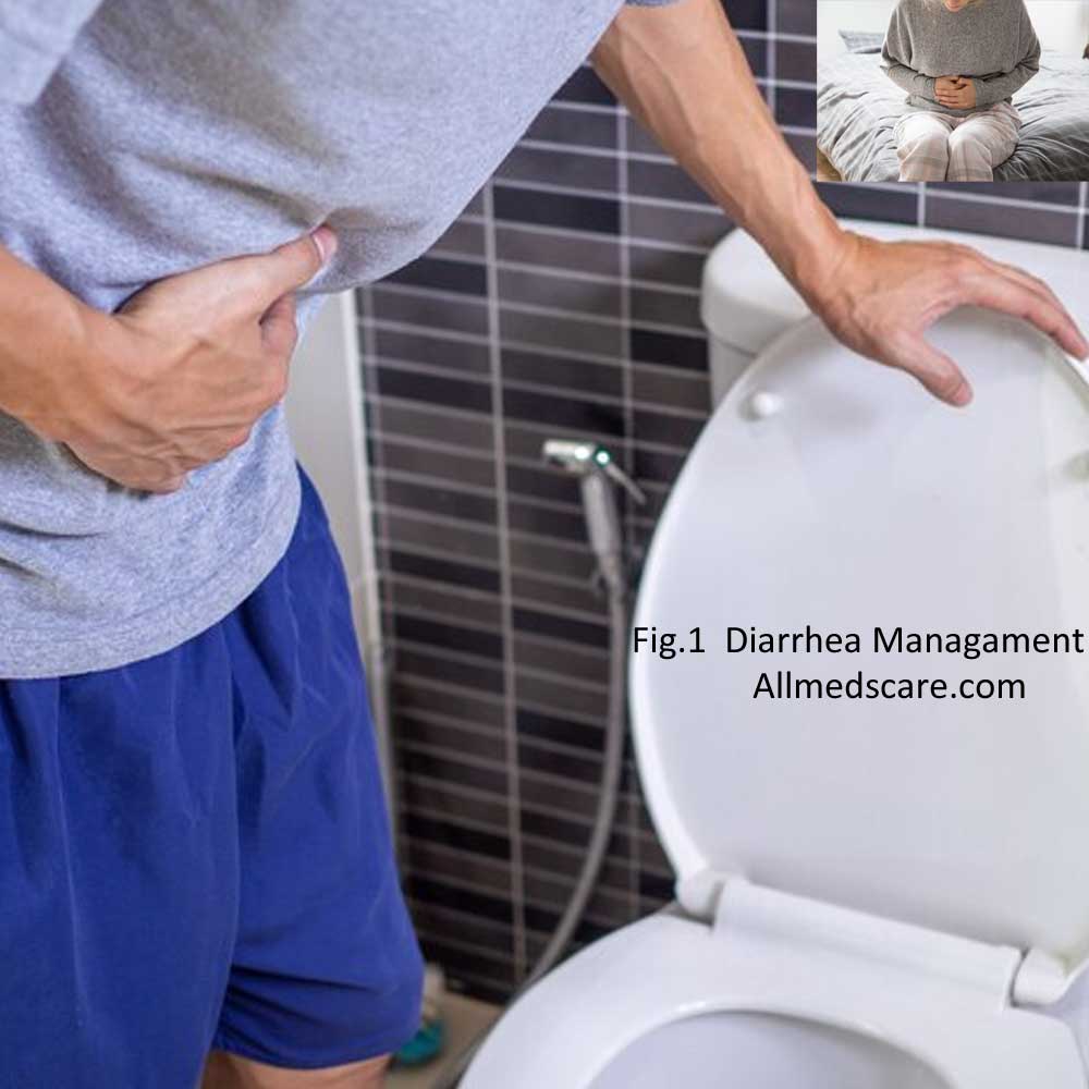Diarrhea Management