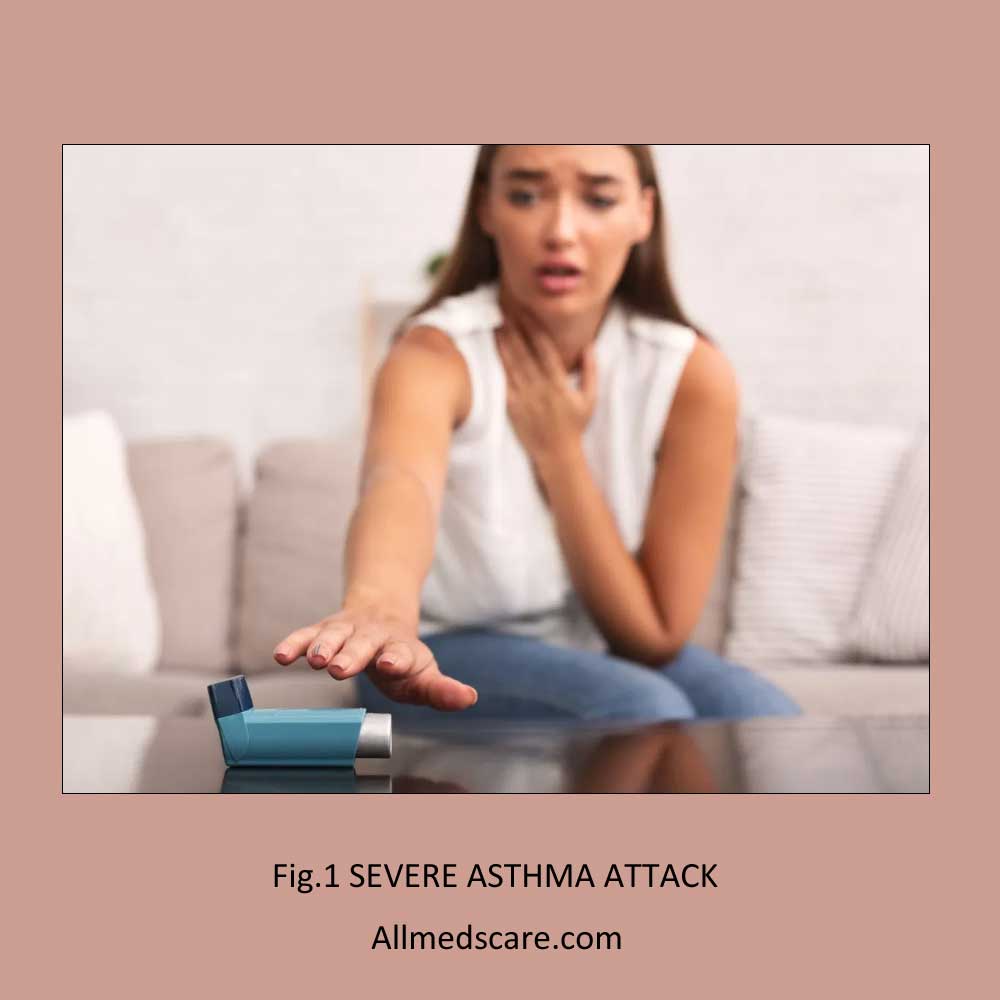 Severe Asthma Attack Allmedscare.com