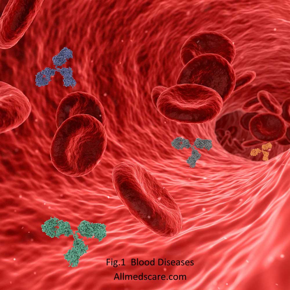 Blood Types & Diseases