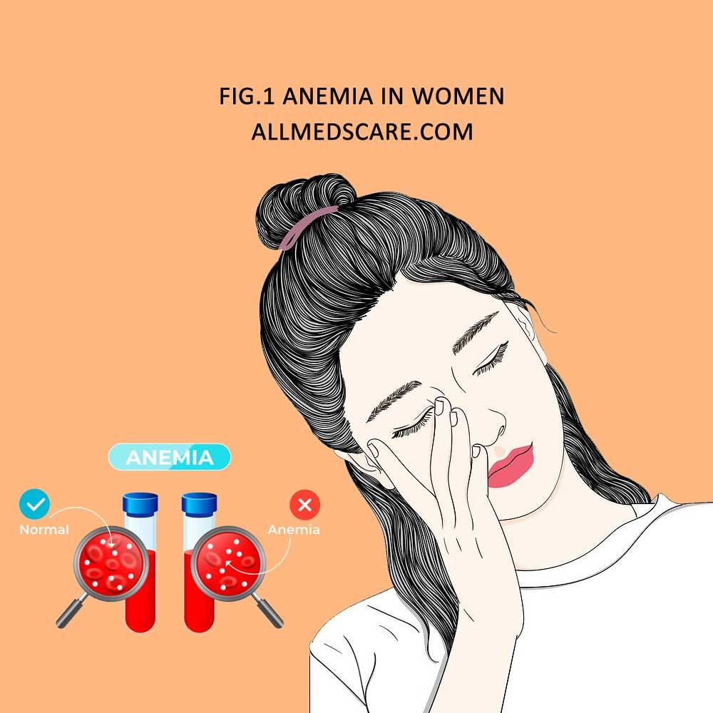 Anemia Symptoms In Women