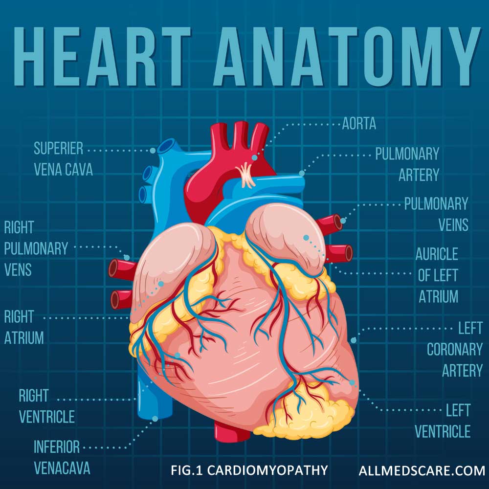 Cardiomyopathy