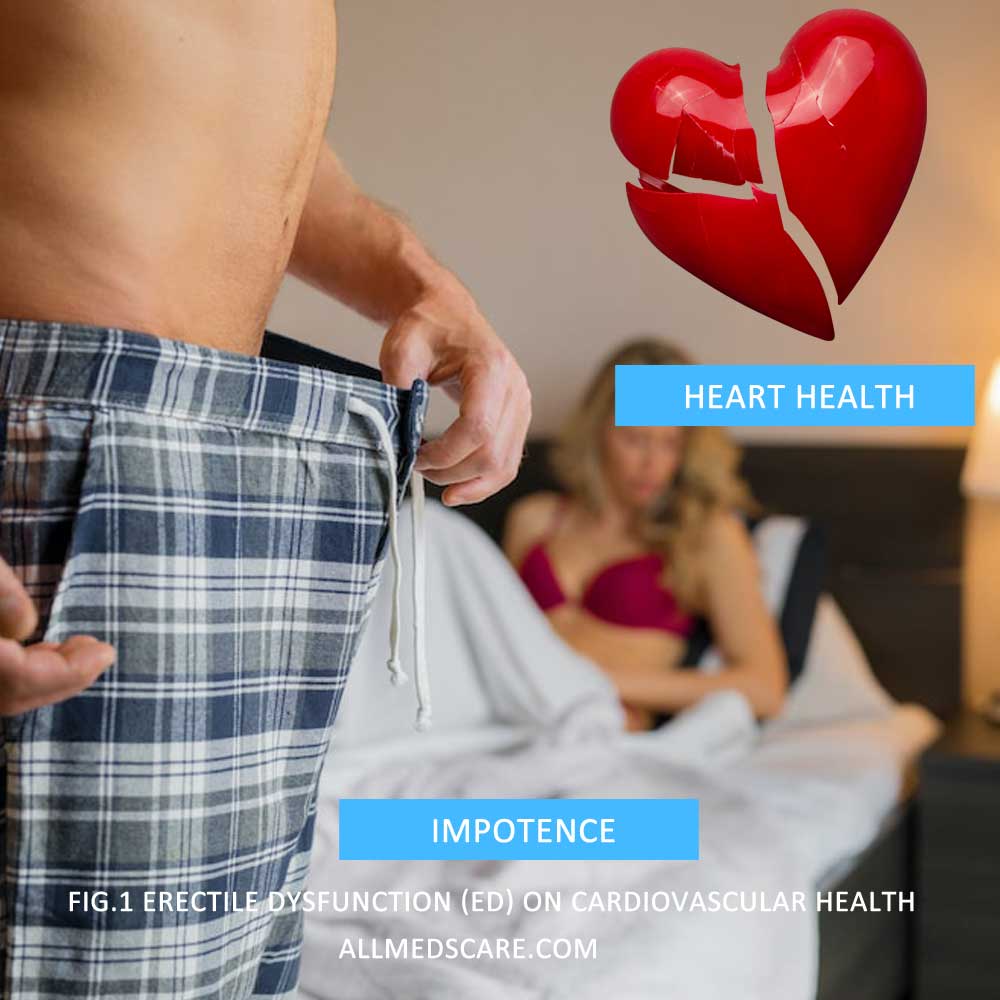 Impact of Erectile Dysfunction (ED) on Cardiovascular Health