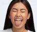 Tongue size structure and Disorders