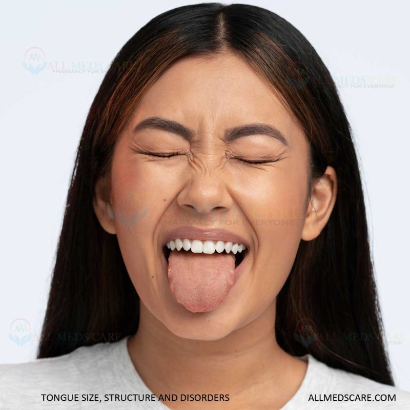 Tongue size structure and Disorders
