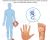 Peripheral Neuropathy