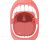 Tonsil Stones 101