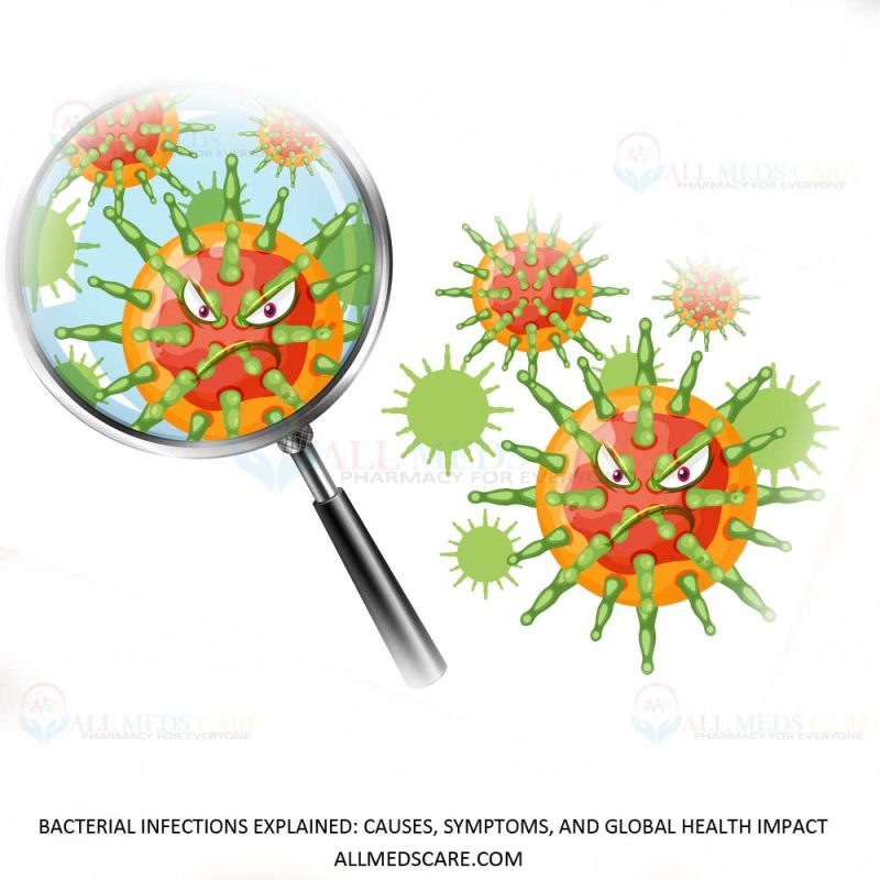 Bacterial Infections