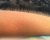 Goosebumps
