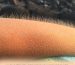Goosebumps