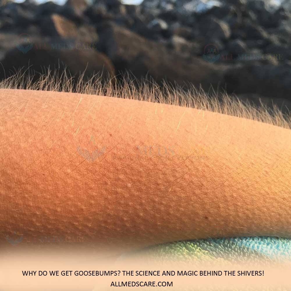 Goosebumps