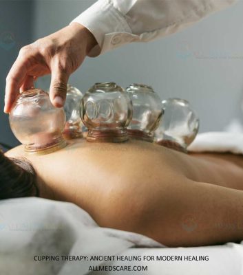 Cupping Therapy ancient Healing