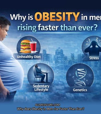 Obesity in Men