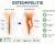 Osteomyelitis Risk Factors Symptoms Recovery