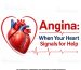 Understanding Angina
