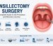 Tonsillectomy