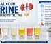 Meaning of Urine Color